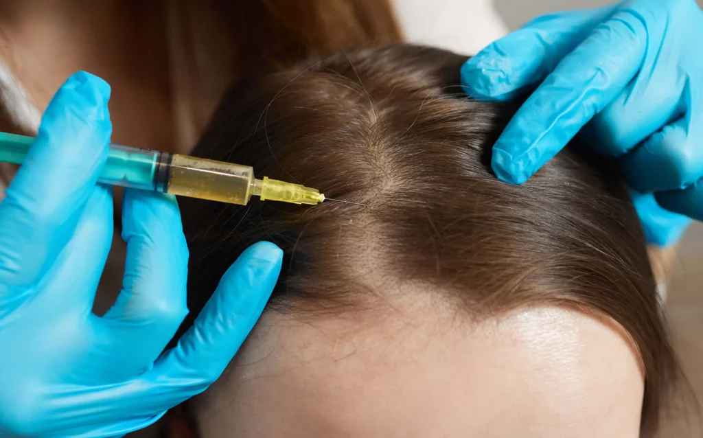 A Woman Receiving Hair Restoration in Kingston, TN at Kim Bell MedSpa