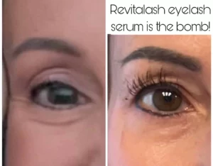 Revitalash Serum at Kim Bell Medspa in Kingston, TN