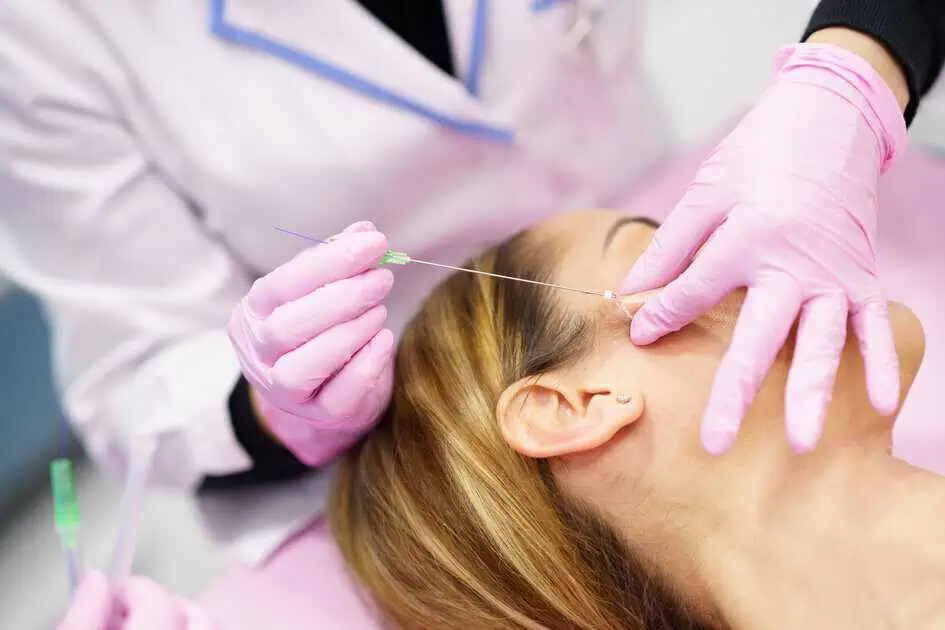 PDO Threads in Kingston, TN by Kim Bell MedSpa