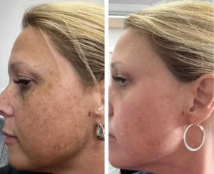 Zo Skin Care at Kim Bell Medspa in Kingston, TN