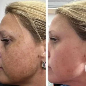 Zo Skin Care at Kim Bell Medspa in Kingston, TN